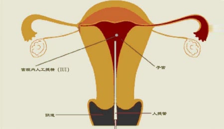 備孕