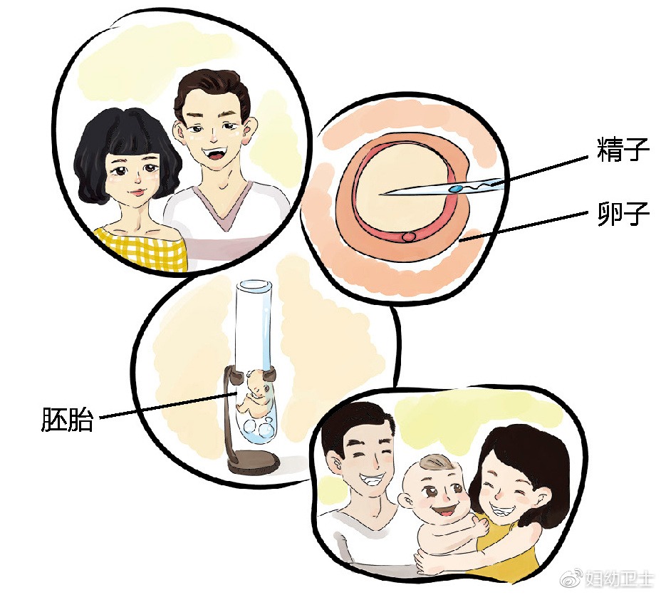 坐月子
