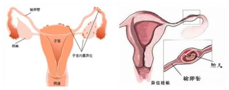 備孕檢查