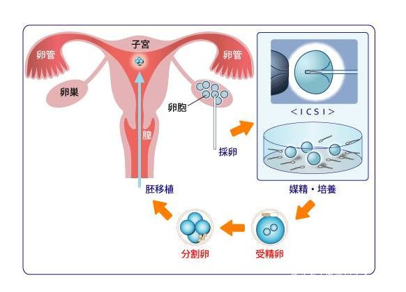 備孕檢查
