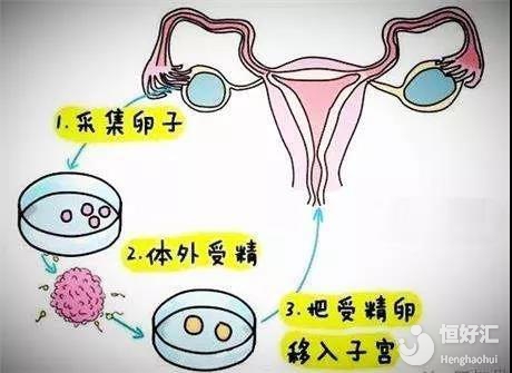 教育孩子